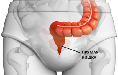 Днепр без рака: когда визит к врачу спасает жизнь. новости Днепра