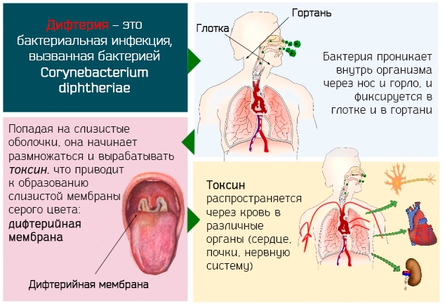 В Днепр вернулась смертельная болезнь из прошлого. Новости Днепра.