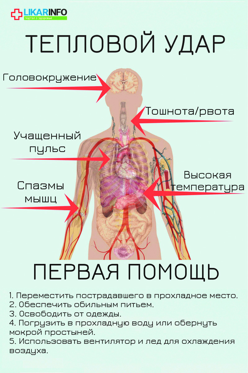 Как днепрянам защититься от теплового удара. Новости Днепра