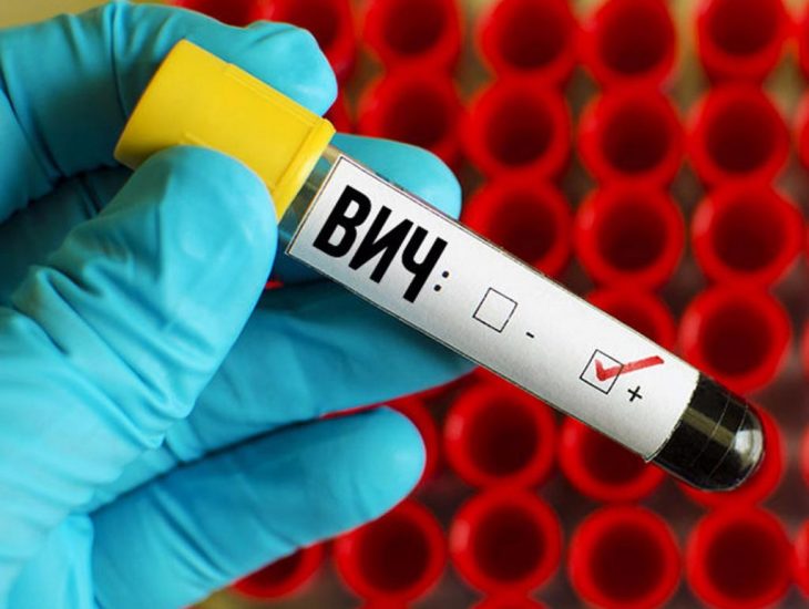 В Днепре 180 новых случаев заражения ВИЧ. Новости Днепра