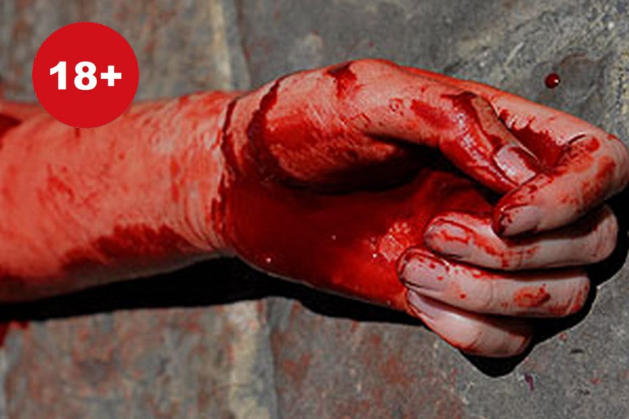 Изуродованное тело и обглоданные руки: под Днепром нашли обезглавленный труп пенсионерки (фото 18+). Новости Днепра