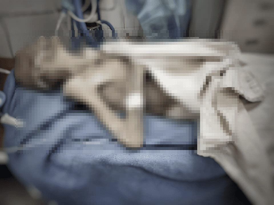 Живая мумия: в Мечникова доставили женщину в состоянии полного истощения и коме 4-й степени. Новости Днепра
