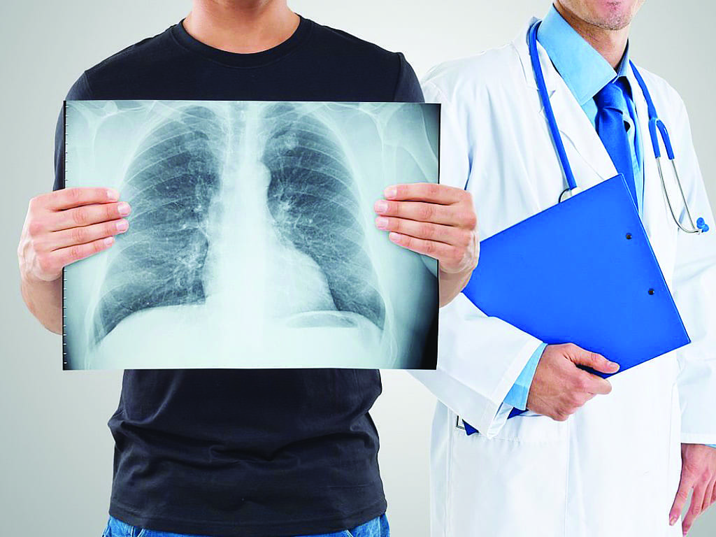 Смертельный кашель: врачи Днепра о том, как распознать и вылечить туберкулез. Новости Днепра