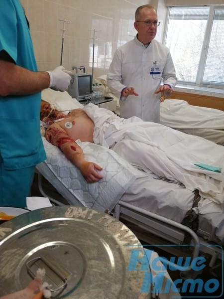 Больше 30 спасателей пришли рано утром сдавать кровь: в Мечникова оперируют саперов, подорвавшихся на мине. Новости Днепра