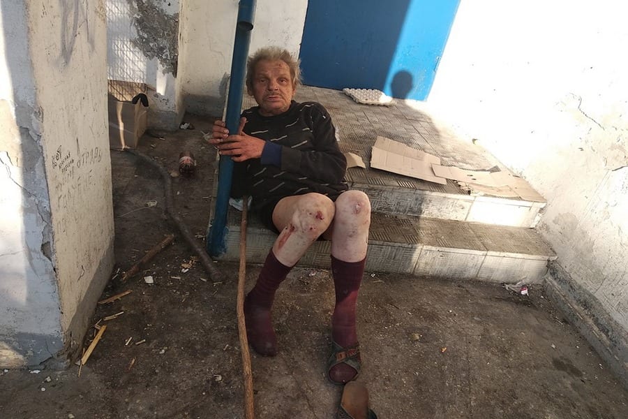 Гниет и подыхает на глазах у всех: под Днепром мужчина живет на мусорнике в центре города