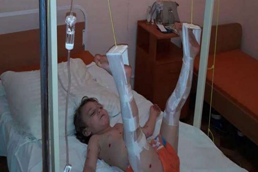 В киевской больнице на ребенка упали сразу три металлические двери