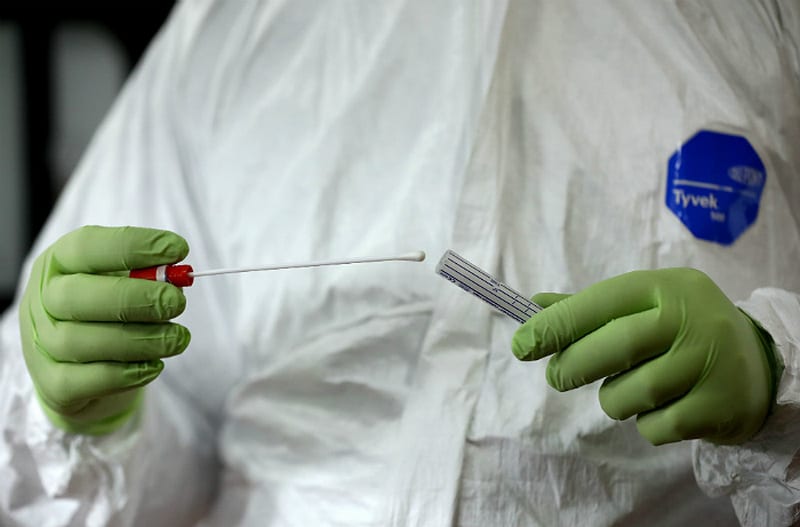 В Украине 7 новых случаев коронавируса, еще одна смерть