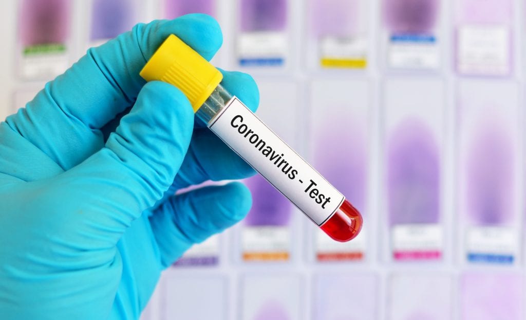 В Днепре и области новые случаи коронавируса: общее количество превысило 300