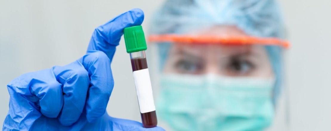 Коронавирус Днепр | статистика | 22.04.20 | Наше місто