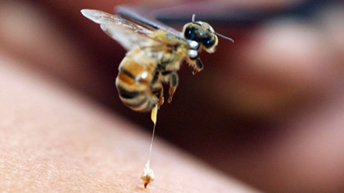 Что делать при укусе осы или пчелы: первая помощь