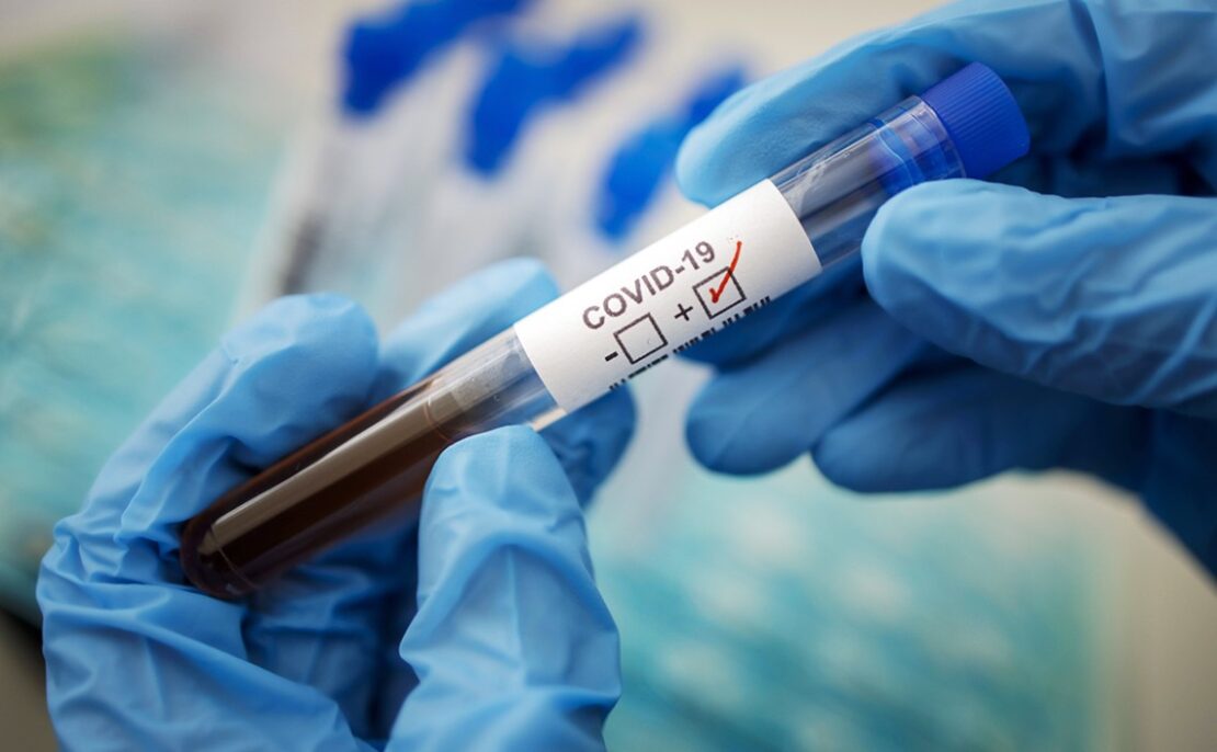 Статистика по коронавирусу в области на 21 апреля – новости Днепра