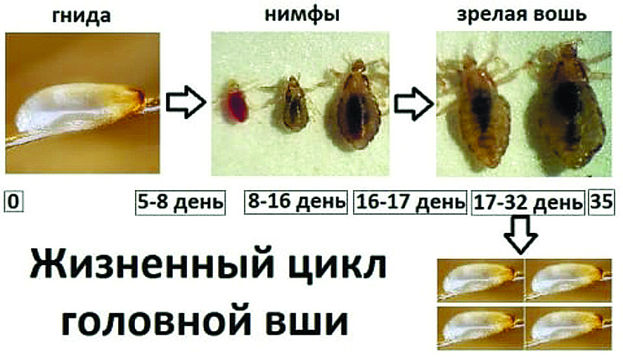 Педикулез у детей