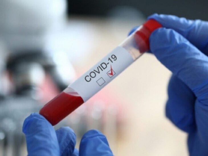 Коронавирус в Украине: очередной антирекорд по заболеваемости COVID-19 за сутки