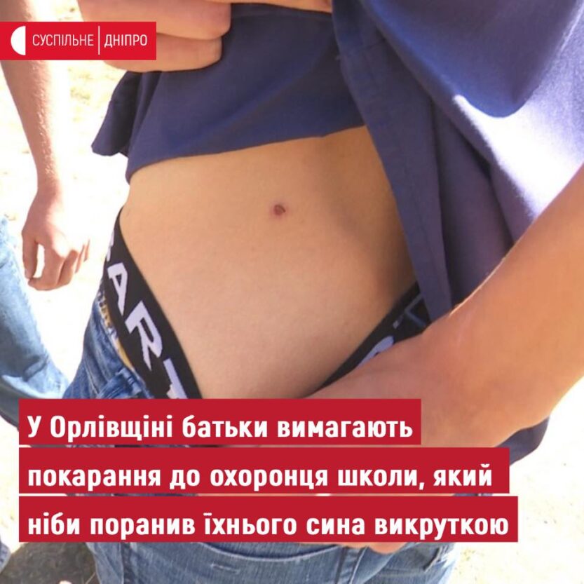 Под Днепром школьный охранник проткнул подростка отверткой. Новости Днепра