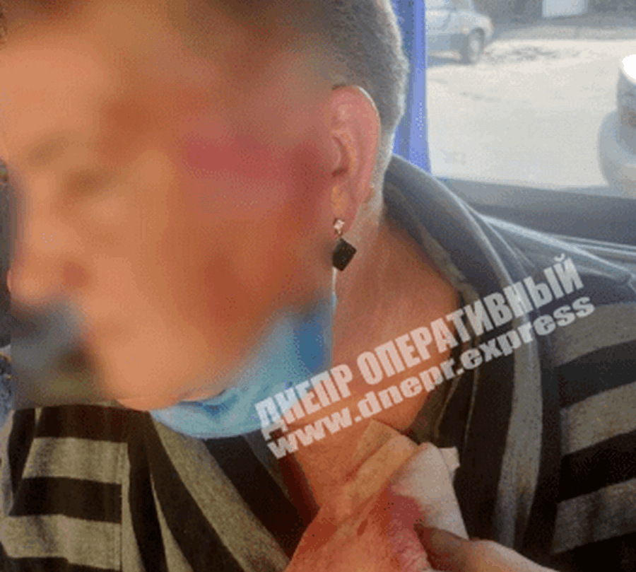 В Днепре пассажирка разбила голову из-за водителя, который резко затормозил
