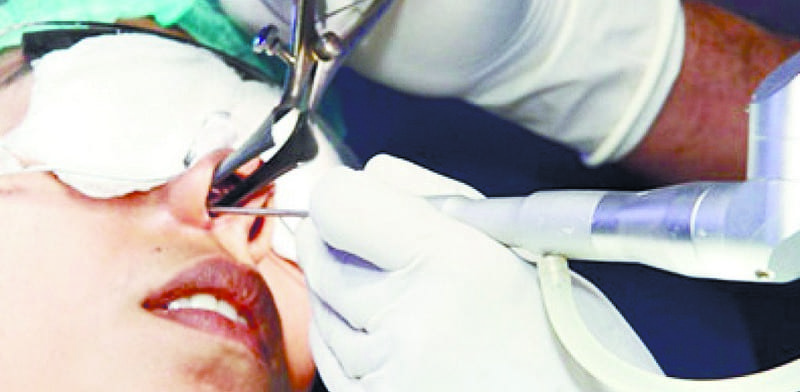 ТОП находок ЛОР-врачей в Днепре. Новости Днепра