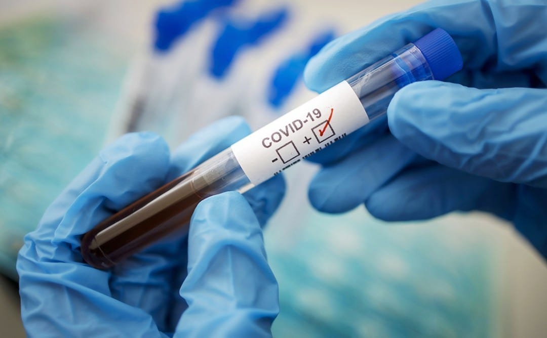 Коронавирус в Днепре: как и где можно сделать тест на COVID-19