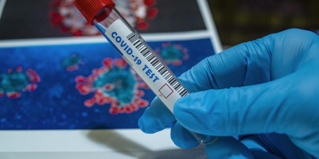Коронавирус в Украине: количество заболевших COVID-19 за сутки резко упало