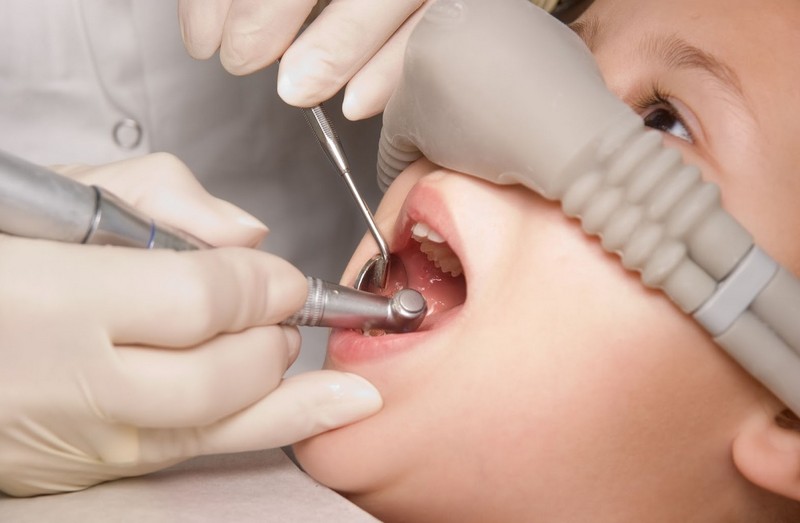 Безопасно ли лечение зубов под седацией