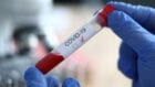Коронавирус в Украине: менее 10 тысяч новых случаев COVID-19 за сутки