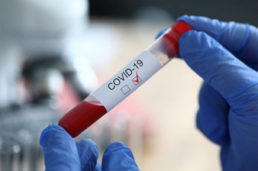 Коронавирус в Украине: менее 10 тысяч новых случаев COVID-19 за сутки