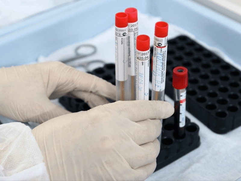 Какие бывают тесты на COVID-19: виды и сроки диагностики