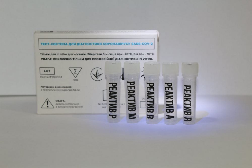 Показывает коронавирус и грипп: в Украине разработали новый ПЦР-тест