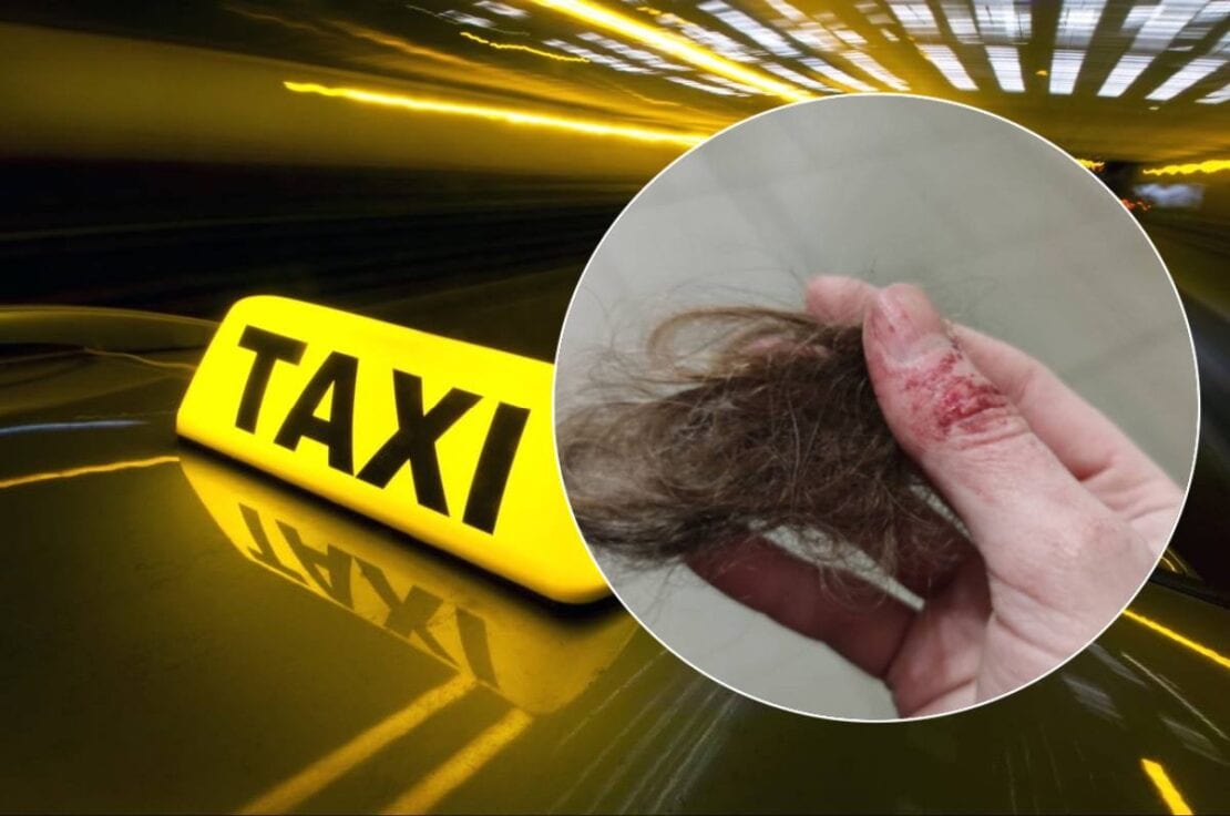 Таксист избил ногами девушку и вырвал клок волос – новости Днепра