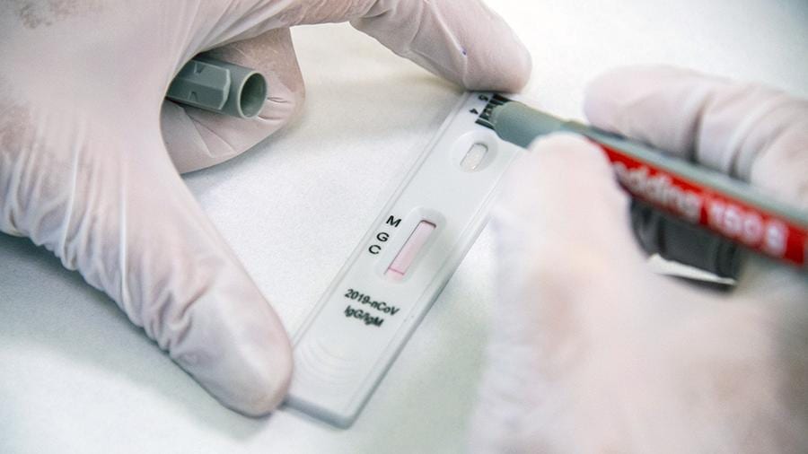 Почему нет смысла делать тест на антитела к коронавирусу – новости Днепра