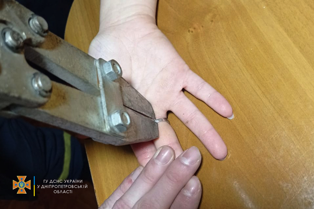 В Днепре спасатели сняли кольцо с пальца 23-летней девушки