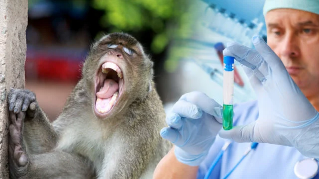 В Україні зареєстрували перший випадок віспи мавп