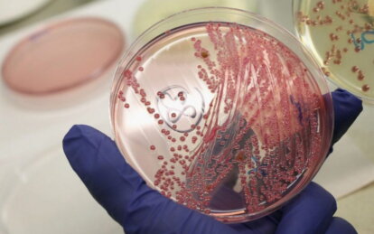 Новини Дніпра: На Київщині виявили сибірку