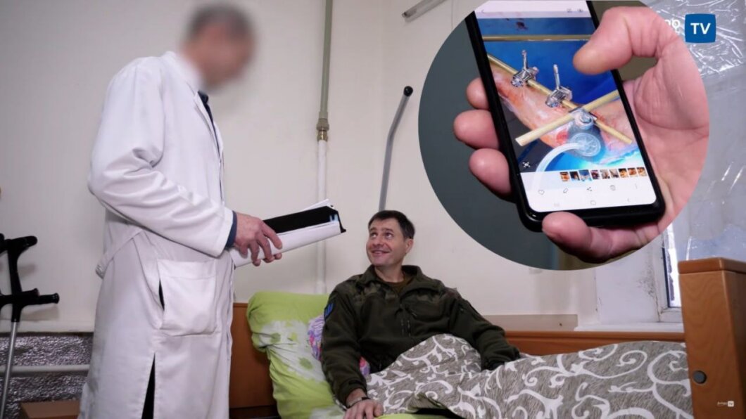 Новини Дніпра: Лікарі Дніпра врятували ногу бійці 93-ї ОМБр