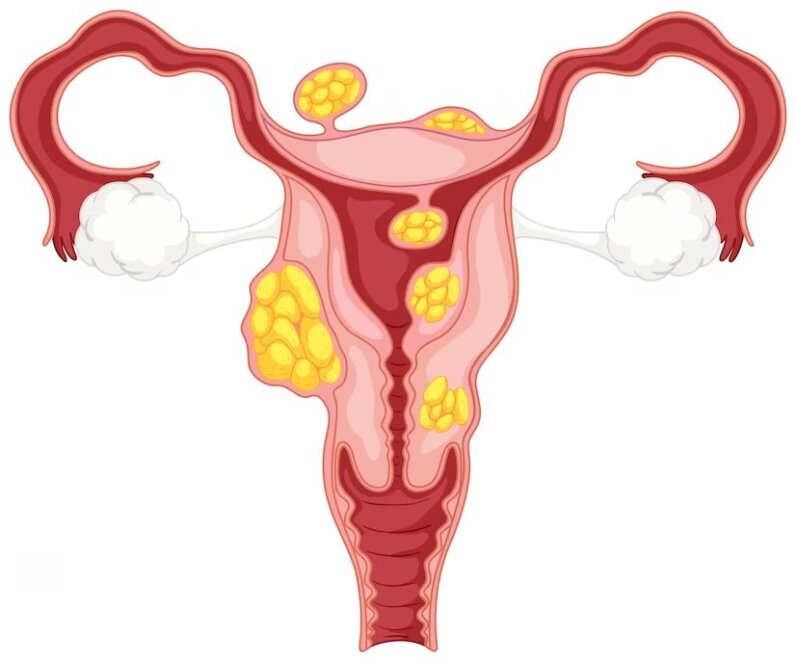 Причины дисфункции репродуктивной системы 
