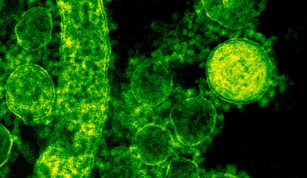 Новий штам коронавірусу Пірола: чим небезпечний і чи допомагає вакцинація