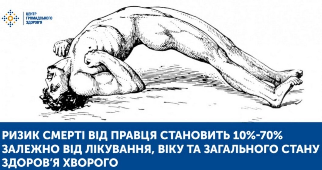 Смерть дитини від правця на Дніпропетровщині 2025 - Наше Місто