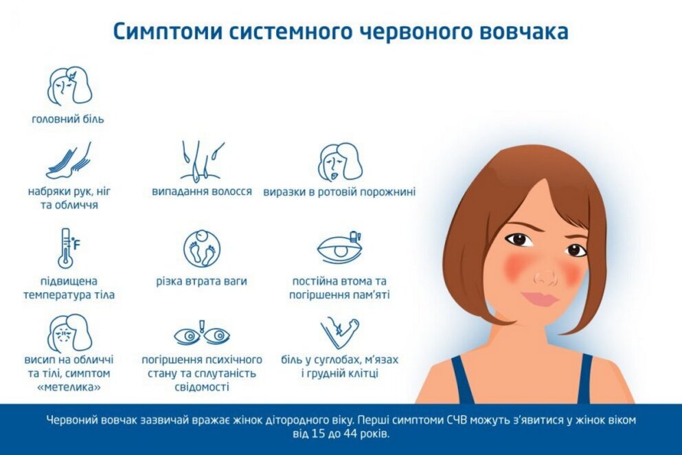 Системний червоний вовчак у Дніпрі 2026 - Наше Місто