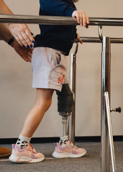 Втратила ногу через обстріл: 5-річна Марійка вчиться ходити на протезі