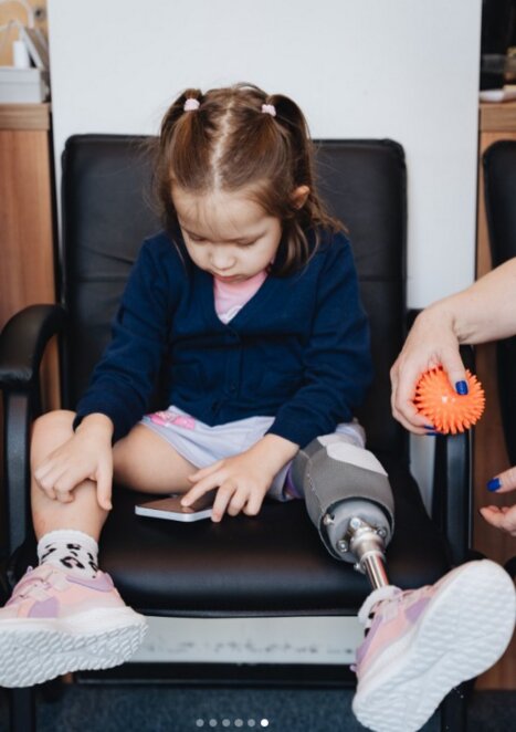 Втратила ногу через обстріл: 5-річна Марійка вчиться ходити на протезі