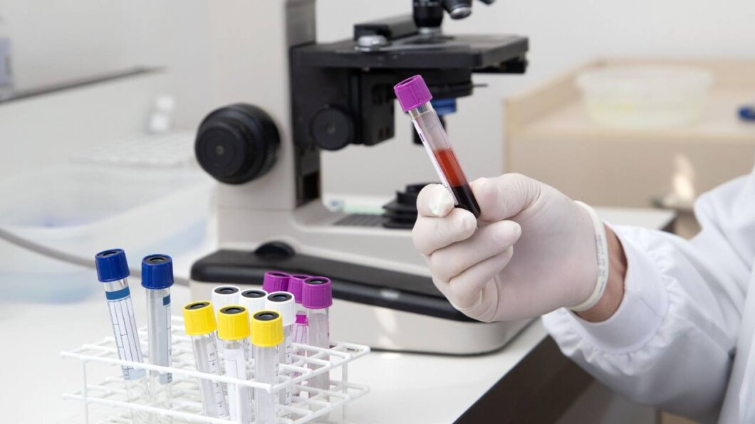 У Дніпрі зафіксовано смерть від грипу А: епідемічна ситуація в області