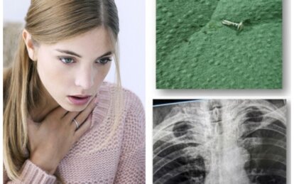 Як у Дніпрі рятують пацієнтів із сторонніми тілами у дихальних шляхах - Наше Місто