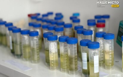 На пляжах Днепра обнаружили холероподобный вибрион: где опасно купаться