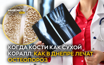 Когда кости как сухой коралл: как в Днепре лечат остеопороз